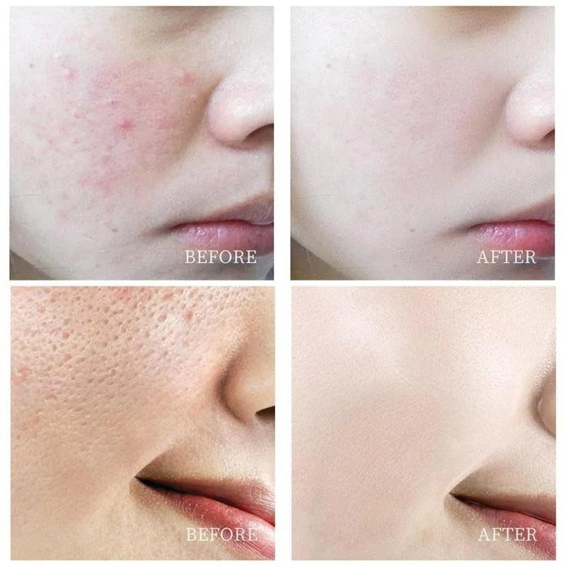 Creme Clareador Corporal